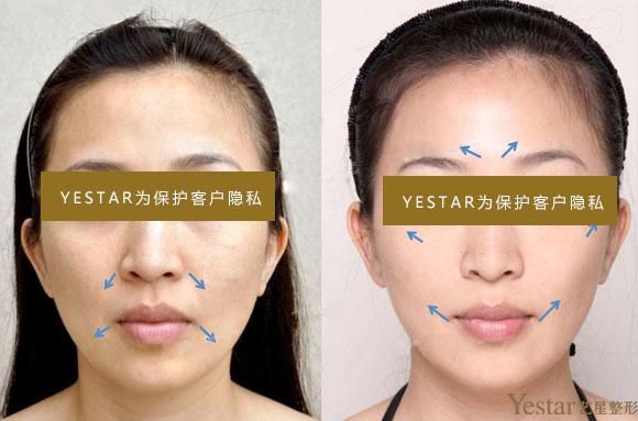 水光补水,1次=4000次皮肤护理