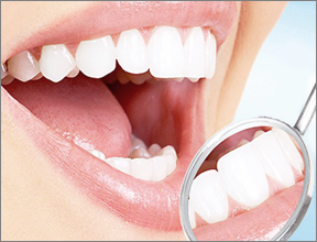 冷光美白 冷光美白