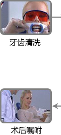 牙齿清洗 术后嘱咐 牙齿清洗 术后嘱咐