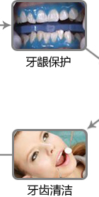 牙龈保护 牙齿清洗 牙龈保护 牙齿清洗