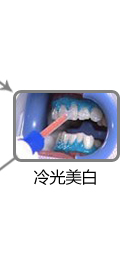 冷光美白 冷光美白