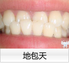地包天 地包天