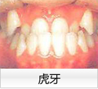 虎牙 虎牙