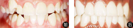 美丽种草前后对比照 美丽种草前后对比照