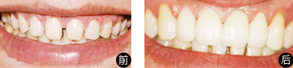 美丽种草前后对比照 美丽种草前后对比照